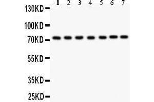 Anti- GCLC antibody, Western blotting All lanes: Anti GCLC  at 0. (GCLC 抗体  (AA 437-637))