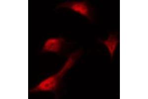 Immunofluorescence (fixed cells) (IF/ICC) image for anti-CCAAT/enhancer Binding Protein (C/EBP), alpha (CEBPA) (pSer21) antibody (ABIN6256190)