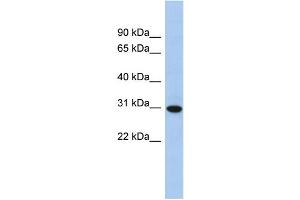 WB Suggested Anti-TMED8 Antibody Titration: 0. (TMED8 抗体  (Middle Region))