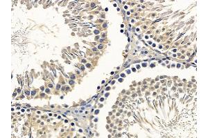 ABIN6257888 and ABIN6275082 at 1/100 staining rat testis tissue by IHC-P.