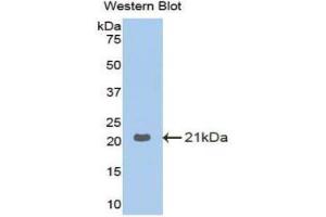 Western Blotting (WB) image for anti-Glucosidase, Alpha, Acid (GAA) (AA 761-919) antibody (ABIN1858935) (GAA 抗体  (AA 761-919))