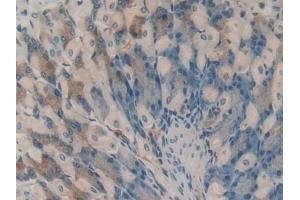 Detection of HAO1 in Mouse Stomach Tissue using Polyclonal Antibody to Hydroxyacid Oxidase 1 (HAO1) (HAO1 抗体  (AA 113-369))