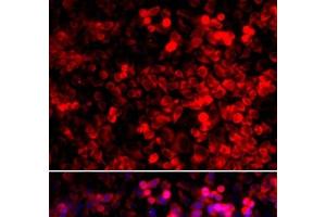 Immunofluorescence analysis of U2OS cells using QARS Polyclonal Antibody (QARS 抗体)