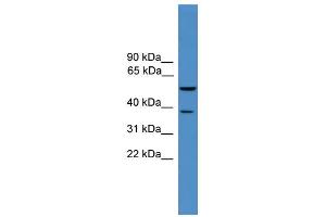 WB Suggested Anti-Bace1 Antibody Titration: 0. (BACE1 抗体  (Middle Region))