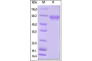 SDS-PAGE (SDS) image for V-Set Domain Containing T Cell Activation Inhibitor 1 (VTCN1) (AA 33-194) protein (Fc Tag,AVI tag,Biotin) (ABIN5674583)