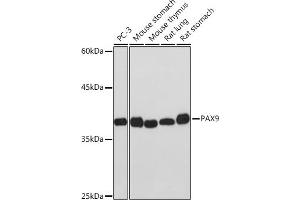 Western blot analysis of extracts of various cell lines, using P Rabbit mAb (ABIN7269156) at 1:1000 dilution. (PAX9 抗体)