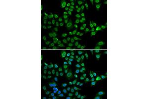 Immunofluorescence analysis of U2OS cells using LMNB2 antibody (ABIN5973877). (Lamin B2 抗体)
