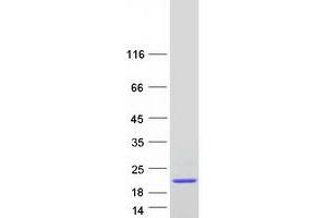 Western Blotting (WB) image for FK506 Binding Protein 2, 13kDa (FKBP2) (Transcript Variant 3) protein (Myc-DYKDDDDK Tag) (ABIN2721211)