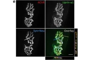 Immunofluorescence (Paraffin-embedded Sections) (IF (p)) image for anti-Protein Tyrosine Phosphatase F Interacting Protein 1 (PPFIA1) (N-Term) antibody (ABIN2856986)