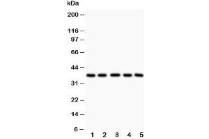 Western blot testing of LOX-1 antibody and Lane 1:  rat liver;  2: human HeLa;  3: (h) K562;  4: (h) Raji lysate. (OLR1 抗体  (Middle Region))