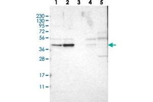 Western blot analysis of Lane 1: RT-4, Lane 2: U-251 MG, Lane 3: Human Plasma, Lane 4: Liver, Lane 5: Tonsil with WDR53 polyclonal antibody  at 1:250-1:500 dilution. (WDR53 抗体)