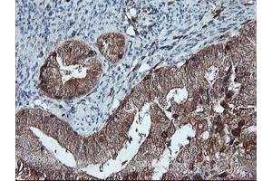 Image no. 2 for anti-LIM Domain Kinase 1 (LIMK1) antibody (ABIN1499146) (LIM Domain Kinase 1 抗体)