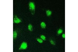 IF analysis of KBTBD2 using anti-KBTBD2 antibody (ABIN6719647). (KBTBD2 抗体)