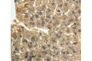 IHC-P analysis of Liver tissue, with DAB staining. (GDF2 抗体  (AA 241-418))