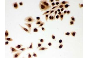 ICC testing of FFPE human SMMC-7721 cells with DDB1 antibody.