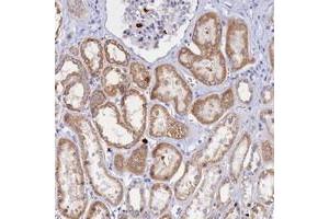 Immunohistochemical staining of human kidney with SLC26A1 polyclonal antibody  shows moderate cytoplasmic positivity in cells in tubules at 1:1000-1:2500 dilution. (SLC26A1 抗体)