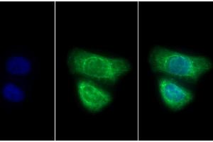 Detection of CK7 in Human HepG2 cell using Polyclonal Antibody to Cytokeratin 7 (CK7) (Cytokeratin 7 抗体  (AA 91-394))