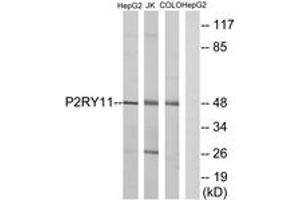 Western blot analysis of extracts from HepG2/Jurkat/COLO cells, using P2RY11 Antibody. (P2RY11 抗体  (AA 140-189))