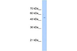 WB Suggested Anti-AGXT2L2 Antibody Titration:  0. (AGXT2L2 抗体  (C-Term))