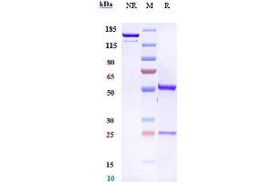 Anti- Human FGFR2( bemarituzumab) on SDS-PAGE under reducing (R) condition.