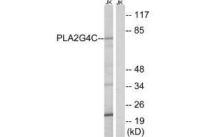Western blot analysis of extracts from Jurkat cells, using PLA2G4C antibody. (PLA2G4C 抗体  (Internal Region))