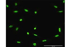 Immunofluorescence of purified MaxPab antibody to ADAR on HeLa cell.