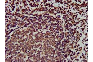 IHC image of ABIN7169782 diluted at 1:200 and staining in paraffin-embedded human lymph node tissue performed on a Leica BondTM system. (SLAMF6 抗体  (AA 248-331))