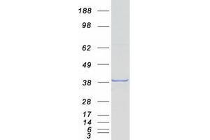 Western Blotting (WB) image for Paired Box 9 (PAX9) protein (Myc-DYKDDDDK Tag) (ABIN2728327)