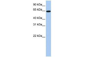 WB Suggested Anti-EPS8L1 Antibody Titration:  0. (EPS8-Like 1 抗体  (Middle Region))