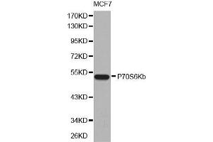 Western blot analysis of extracts of MCF7 cell line, using P70S6Kb antibody. (RPS6KB2 抗体  (AA 1-170))