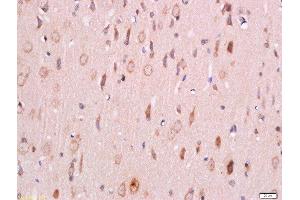 Immunohistochemistry (Paraffin-embedded Sections) (IHC (p)) image for anti-3-phosphoinositide Dependent Protein Kinase-1 (PDPK1) (pSer241) antibody (ABIN744668)