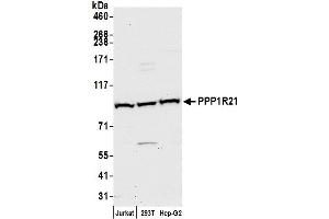anti-KLRAQ Motif Containing 1 (KLRAQ1) (AA 125-175) antibody