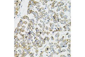Immunohistochemistry (Paraffin-embedded Sections) (IHC (p)) image for anti-Protein Phosphatase 1, Catalytic Subunit, alpha Isoform (PPP1CA) (AA 1-330) antibody (ABIN6146053)
