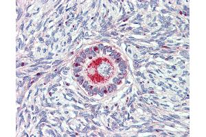 Anti-TM9SF1 antibody IHC of human ovary. (TM9SF1 抗体  (Internal Region))