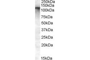 Western Blotting (WB) image for anti-Family with Sequence Similarity 91, Member A1 (FAM91A1) (N-Term) antibody (ABIN2791513) (FAM91A1 抗体  (N-Term))