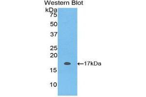 Western Blotting (WB) image for anti-S100 Protein (S100) (AA 1-94) antibody (ABIN1171951) (S100 Protein (S100) (AA 1-94) 抗体)
