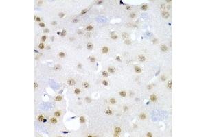 Immunohistochemistry of paraffin-embedded mouse brain using CDC27 antibody (ABIN3015756, ABIN3015757, ABIN1679113 and ABIN6219104) at dilution of 1:200 (40x lens). (CDC27 抗体  (AA 551-830))