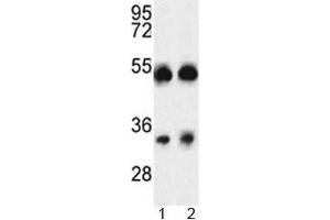Western blot analysis of ORAI1 antibody and A375 cell line and mouse testis tissue lysate (ORAI1 抗体  (AA 145-173))