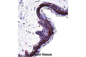 Immunohistochemistry (IHC) image for anti-Proteasome (Prosome, Macropain) Subunit, beta Type, 5 (PSMB5) antibody (ABIN2998050) (PSMB5 抗体)