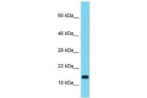 Host: Rabbit Target Name: IDNK Sample Type: OVCAR-3 Whole Cell lysates Antibody Dilution: 1. (IdnK 抗体  (N-Term))