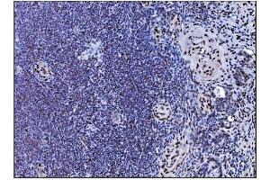IHC analysis of Serum Response Factor/SRF using anti-Serum Response Factor/SRF antibody (ABIN7600213).