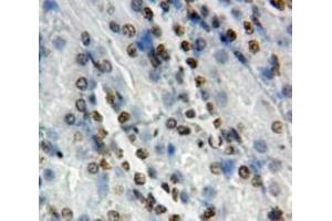 Used in DAB staining on fromalin fixed paraffin-embedded Kidney tissue (NOTCH2 抗体  (AA 2251-2466))