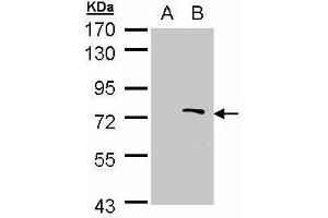 WB Image Western Blot analysis of ZMYND11 expression in transfected 293T cell line by ZMYND11 polyclonal antibody. (ZMYND11 抗体)