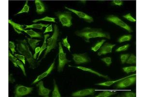 Immunofluorescence of monoclonal antibody to EPB41L3 on HeLa cell. (EPB41L3 抗体  (AA 915-1007))