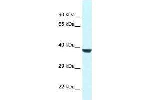 WB Suggested Anti-Wdr45l Antibody   Titration: 1. (WD Repeat Domain 45B (WDR45B) (N-Term) 抗体)