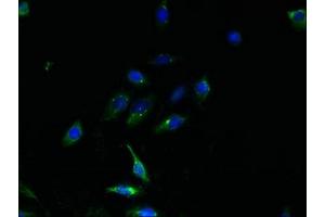 Immunofluorescent analysis of HepG2 cells using ABIN7164800 at dilution of 1:100 and Alexa Fluor 488-congugated AffiniPure Goat Anti-Rabbit IgG(H+L)
