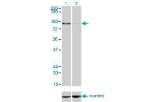 Western blot analysis of ZW10 over-expressed 293 cell line, cotransfected with ZW10 Validated Chimera RNAi (Lane 2) or non-transfected control (Lane 1). (ZW10 抗体  (AA 1-100))