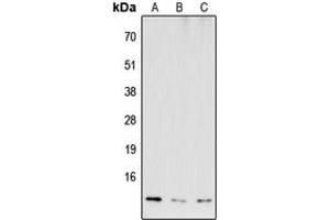 Western blot analysis of COX6B2 expression in HEK293T (A), NS-1 (B), H9C2 (C) whole cell lysates. (COX6B2 抗体  (Center))
