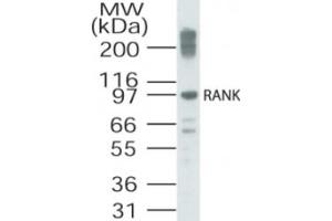 Western Blotting (WB) image for anti-Tumor Necrosis Factor Receptor Superfamily, Member 11a, NFKB Activator (TNFRSF11A) (AA 603-613) antibody (ABIN2470155)