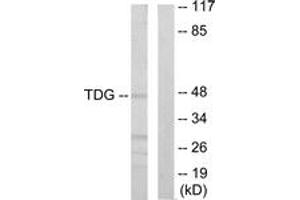 Western blot analysis of extracts from Jurkat cells, using TDG Antibody.